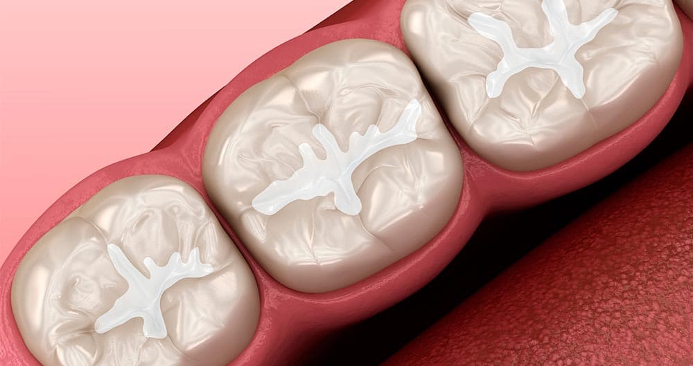 Description of image